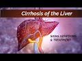 Cirrhosis of the Liver | Signs, Symptoms, & Treatment | Liver Cirrhosis Medical Animation