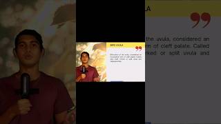 Word of the Day #17 | Bifid Uvula | Bifid Uvula | Dr. Ravitesh Prasad