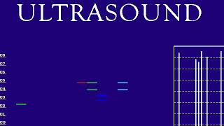 Gravis Ultrasound - Pro Patches Lite - GOTTOGET.MID