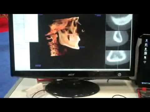 Anatomage 3D Cephalometric Analysis.mp4