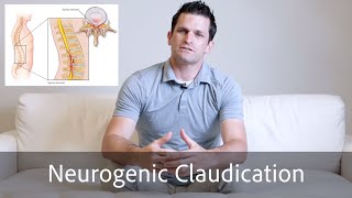 Neurogenic Claudication // spinal stenosis