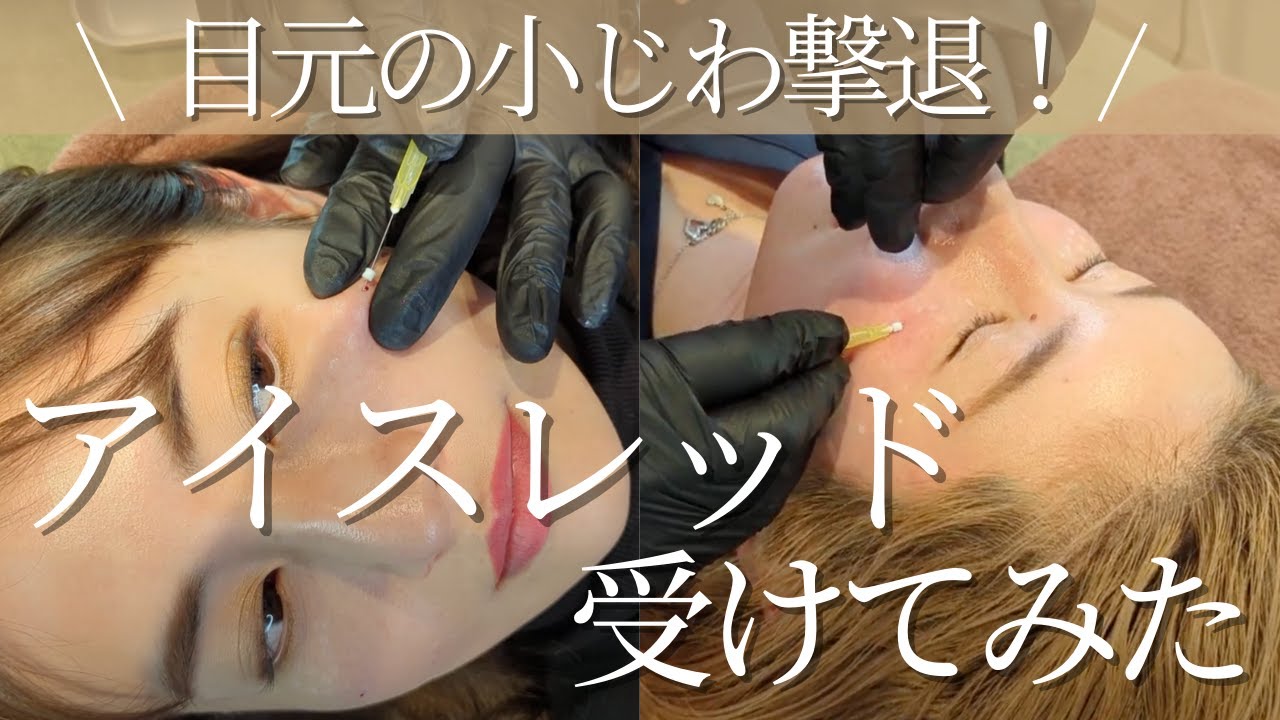 【アイスレッド】受けてみた！！