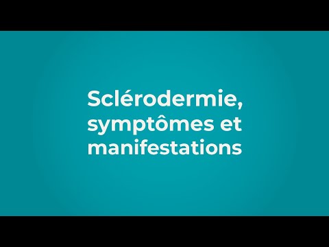 Vidéo: Sclérodermie - Causes, Symptômes Et Complications De La Sclérodermie