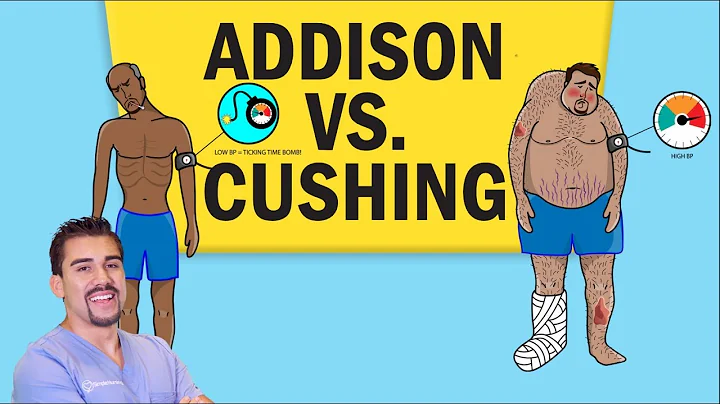 Addisons vs Cushing's Disease for NCLEX RN