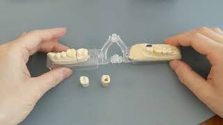 Can you kill the tooth pain nerve in 3 seconds permanently?