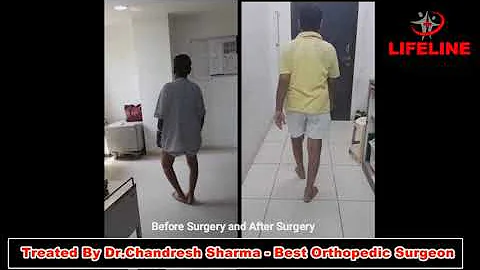 Before & After - Knee Replacement Surgery - Dr. Ch...