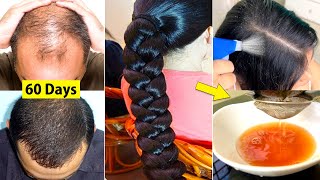 The Secret To FAST Hair Growth - Regrow Lost Hair From Roots | तेजी से हेयर ग्रोथ कैसे करें?