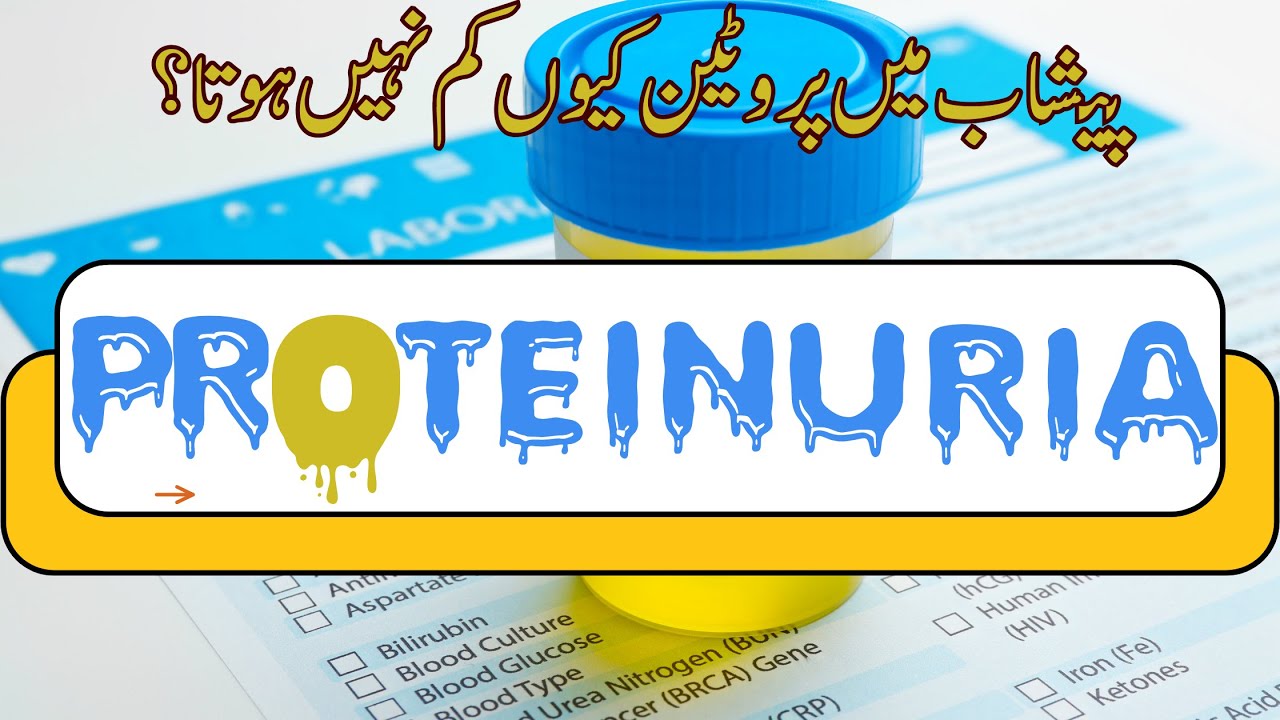 Can't Improve Your Proteinuria? Discover Reasons & Solutions - Ep. 91 | AwaisZaka.com