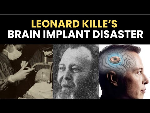 Leonard Kille's brain implant disaster
