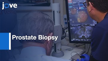 Prostate Biopsy using MRI-ultrasound Fusion | Protocol Preview