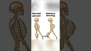 ¿Por qué Sterling corre tan raro?