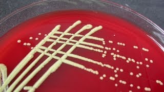 Identification of microbes with MALDI-TOF mass spectrometry. Net Worth