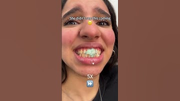 Looking for a brighter smile? 🦷 The secret is choosing the perfect toothpaste!#bodyaccel