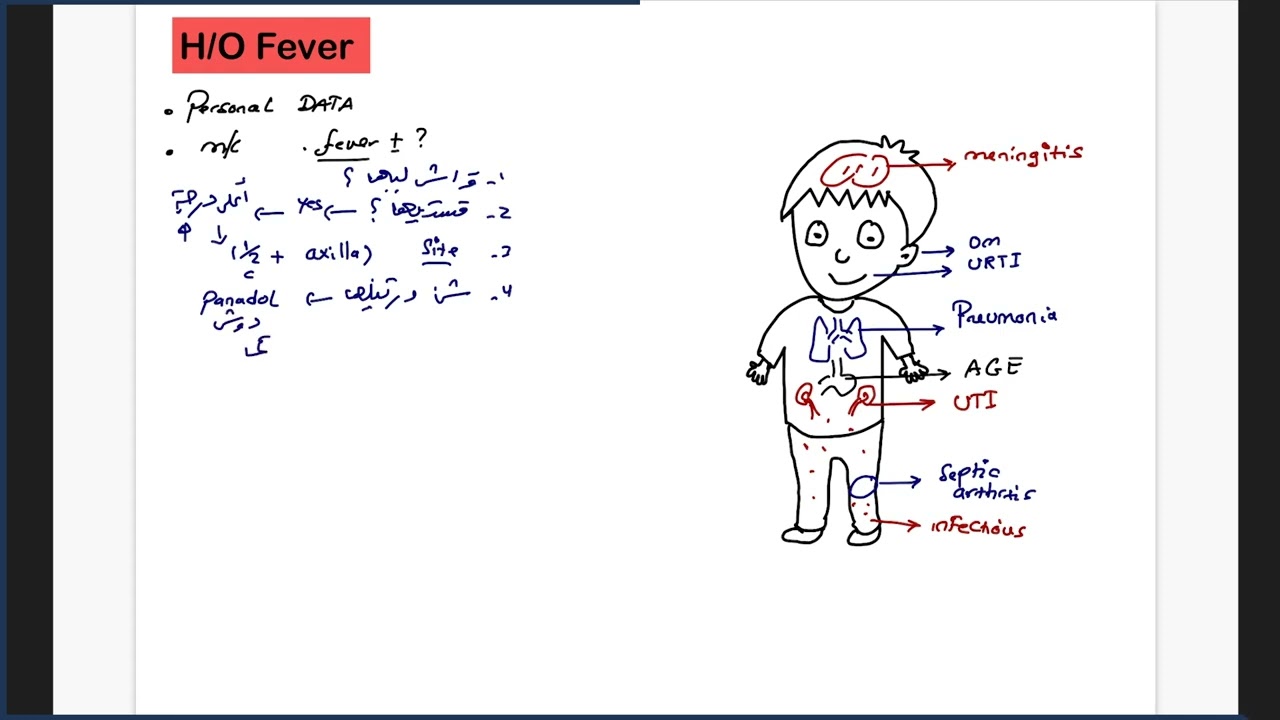 HO Fever - د.عبد الرحمن الجعكي