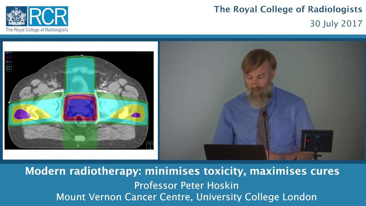 Modern radiotherapy – minimises toxicity, maximises cures