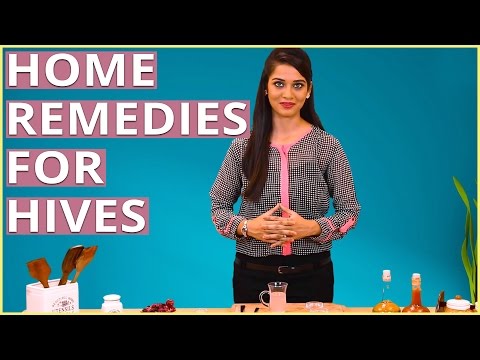 2 Best Home Remedies To GET RID OF HIVES Naturally