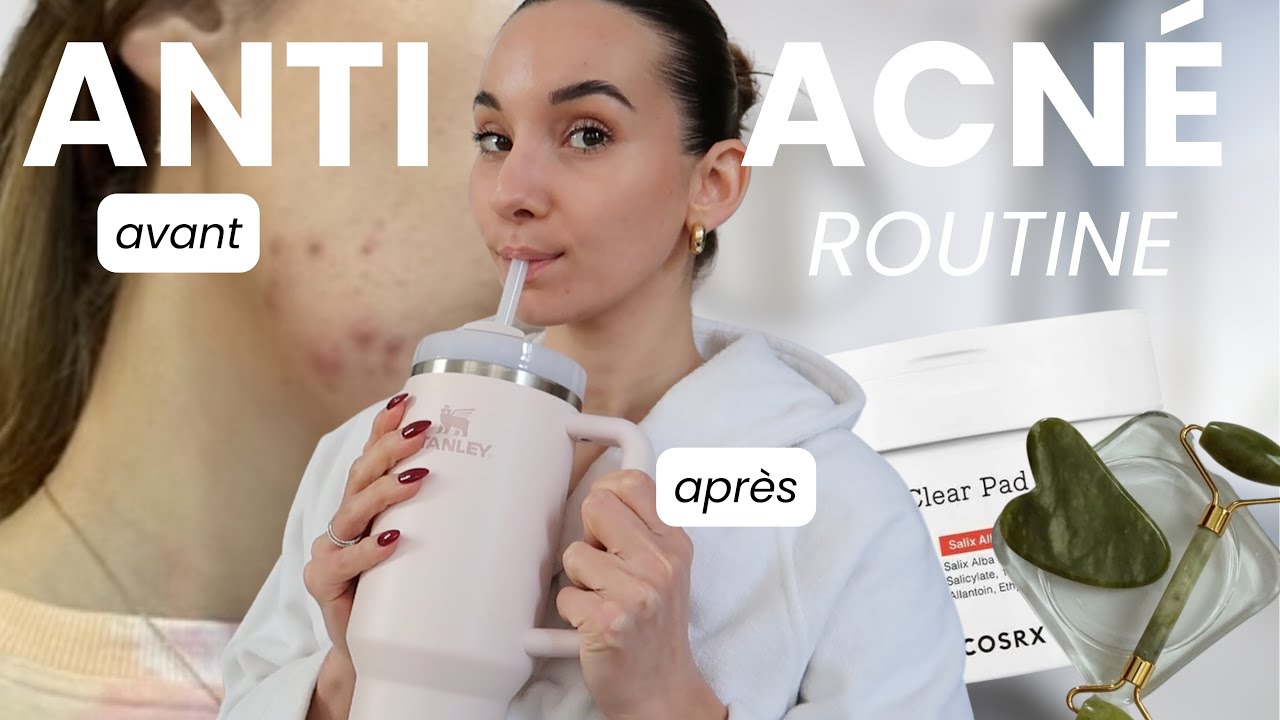 Skin Care ANTI-ACNÉ (Hormonal) 🌸 : Routine, Skin Cycling & Conseils l Vlogmas 3
