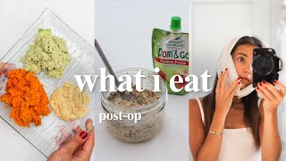 what I ate after my wisdom teeth removal | soft, quick & healthy meals screenshot 2