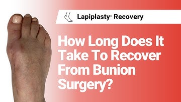 How Long Does It Take To Recover From Bunion Surgery? | Lapiplasty® Recovery
