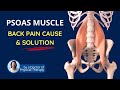 Psoas Muscle - Pelvic Tilt & Hip Flexion | Back Pain Fix