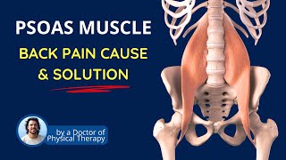 Psoas Muscle  Pelvic Tilt & Hip Flexion | Back Pain Fix