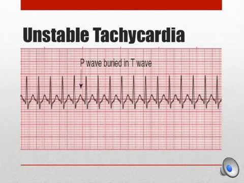 acls-2015-mega-code