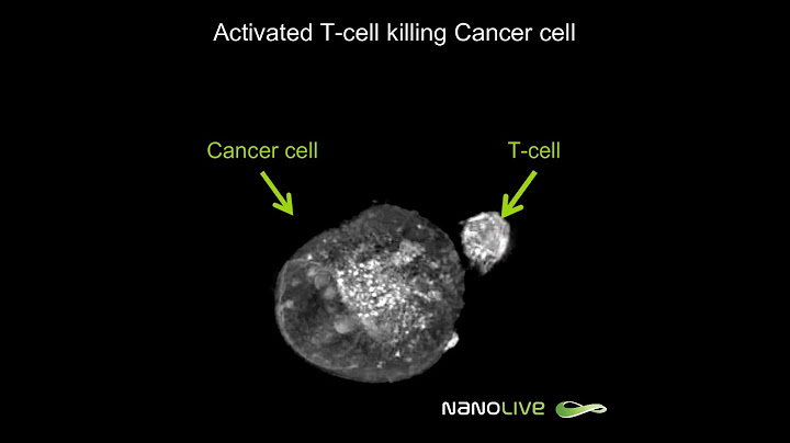 Label-free Live Cell Imaging: Activated T-Cell Killing Cancer Cell