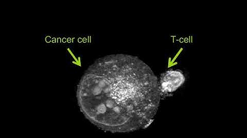 Label-free Live Cell Imaging: Activated T-Cell Killing Cancer Cell
