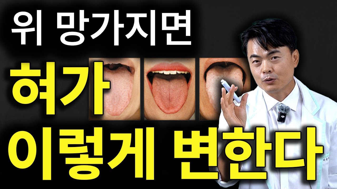거울로 혀를 확인하세요ㅣ혀 앞에는 티가 안 난다. 혈액, 진액, 기력 고갈 전조증상