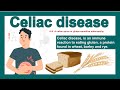 Celiac disease | Gluten intolerance | What happens when you have celiac disease?