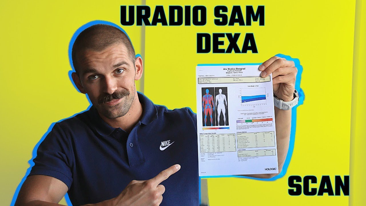 DEXA Scan – Najprecizniji test tvog tela!