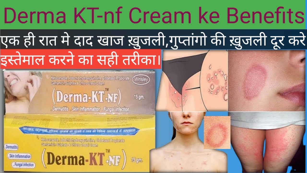 Derma KT Cream Ke Fayde Derma KT Cream Uses In Hindi Drx Farooq derma-kt-cream-ke-fayde-derma-kt-cream-uses-in-hindi-drx-farooq