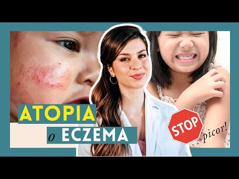 Video: Psicoterapia De La Dermatitis Atópica En Niños