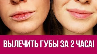 👍 Как быстро восстановить губы? Экспресс вариант за 2 часа! 😲