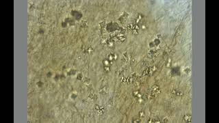 RLC1393 2 - 7004755