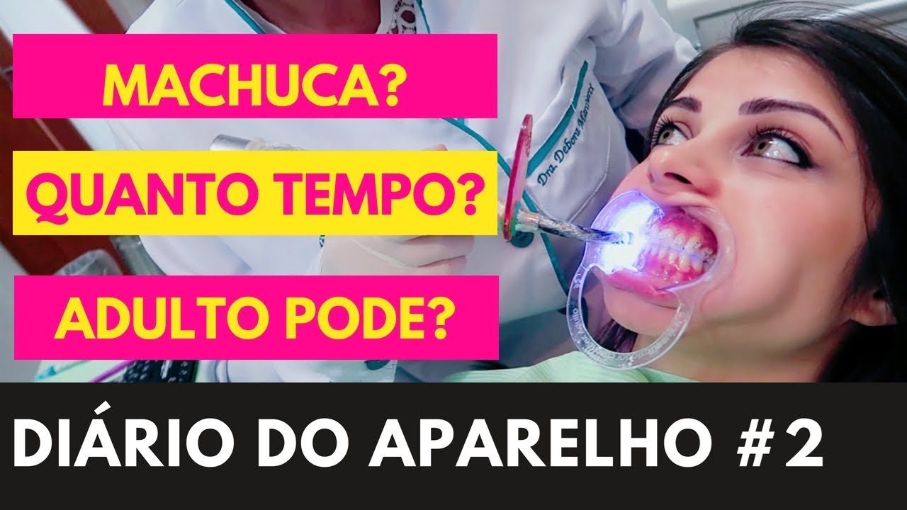 COLOCANDO O APARELHO AUTOLIGADO ESTÉTICO