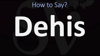 How to Pronounce Dehis? (CORRECTLY)