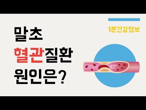 [건강정보] 말초혈관질환이 생기는 원인은?