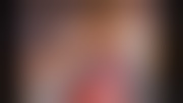 Lap Appendectomy in Acute APPENDICITIS