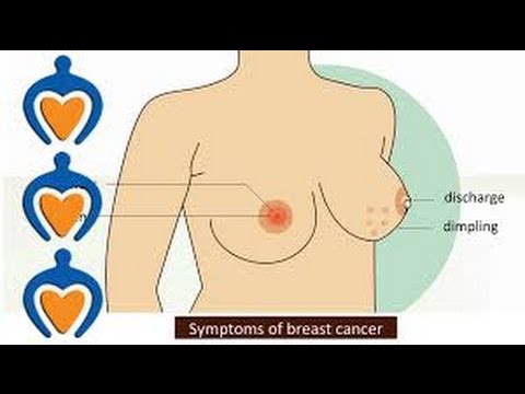 follow up after breast cancer latina cum swallowing