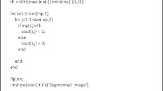 MATLAB CODE for Tumor segmentation