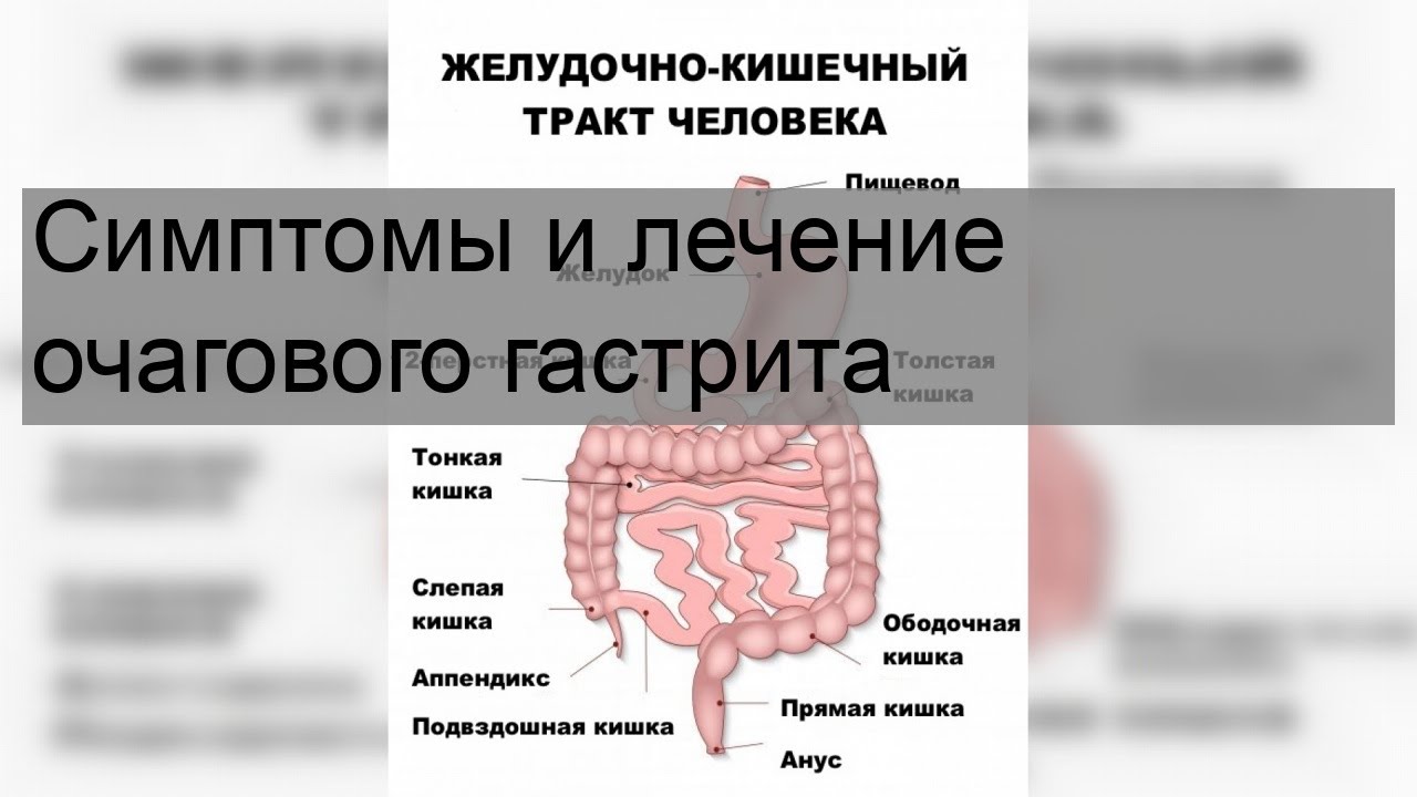 Колики кишечника симптомы и лечение у взрослых