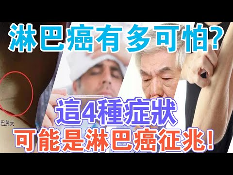 注意！出現這4種症狀，可能是淋巴癌徵兆！預防的方法就在身邊！