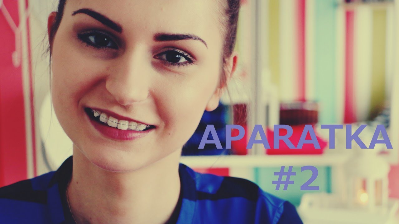 APARATKA #2 - pierwszy miesiąc, wyrwane ósemki, wymiana gumek i drutu, pierwsze podkręcanie