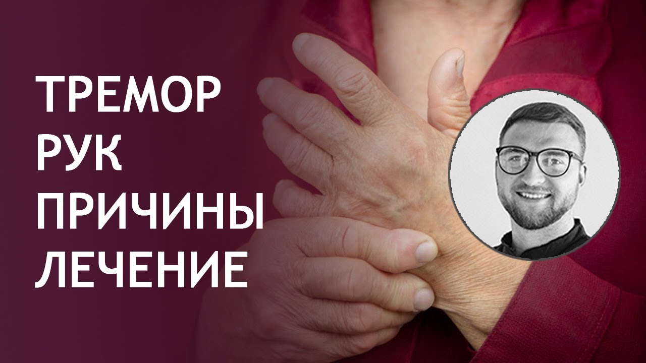 Трясутся руки у пожилого человека причина и лечение. Тремор рук что это причины. Тремор рук что это причины. Постуральный тремор головы. Тремор рук.