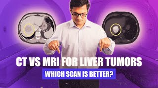 Ct Vs Mri For Liver Tumors Which Scan Is Better For Diagnosis & Treatment?