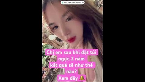 Kết quả hết hồn sau khi đặt túi ngực 2 năm tại BV thẩm mỹ Emcas -BS. Khiêm #emcas #lamdep #nangnguc