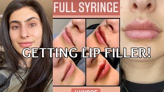 I GOT LIP FILLER Before After and Healing Process Restylane Kysse Lip Filler