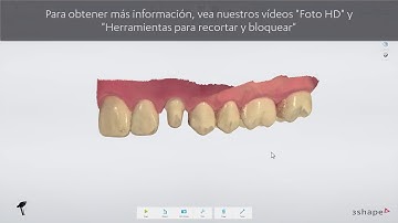 3Shape TRIOS - Scan page ES
