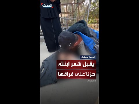 أب فلسطيني مصاب بجروح يقبل شعر طفلته التي قتلت في القصف الإسرائيلي